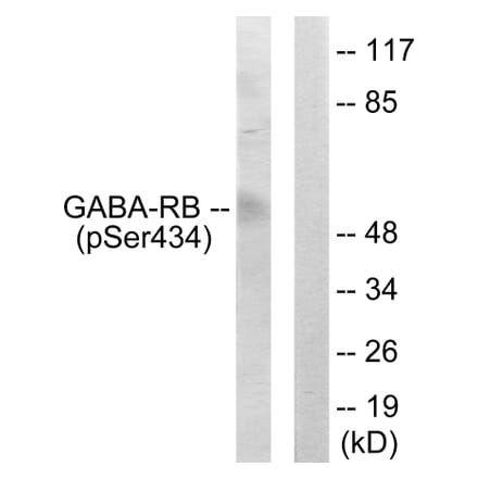 Western Blot - Anti-GABA-RB (phospho Ser434) Antibody (A0011) - Antibodies.com