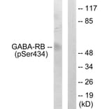 Western Blot - Anti-GABA-RB (phospho Ser434) Antibody (A0011) - Antibodies.com