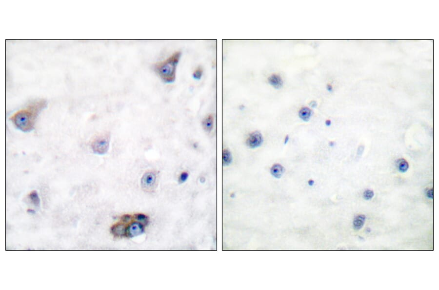 Immunohistochemistry - Anti-GABA-RB (phospho Ser434) Antibody (A0011) - Antibodies.com
