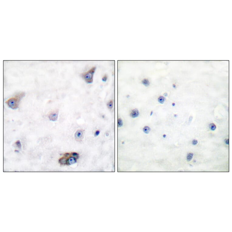 Immunohistochemistry - Anti-GABA-RB (phospho Ser434) Antibody (A0011) - Antibodies.com
