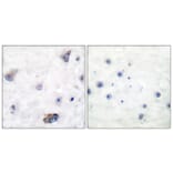 Immunohistochemistry - Anti-GABA-RB (phospho Ser434) Antibody (A0011) - Antibodies.com