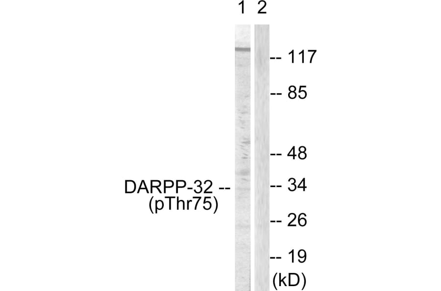 Western Blot - Anti-DARPP-32 (phospho Thr75) Antibody (A0007) - Antibodies.com