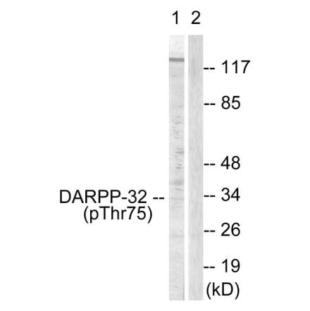 Western Blot - Anti-DARPP-32 (phospho Thr75) Antibody (A0007) - Antibodies.com