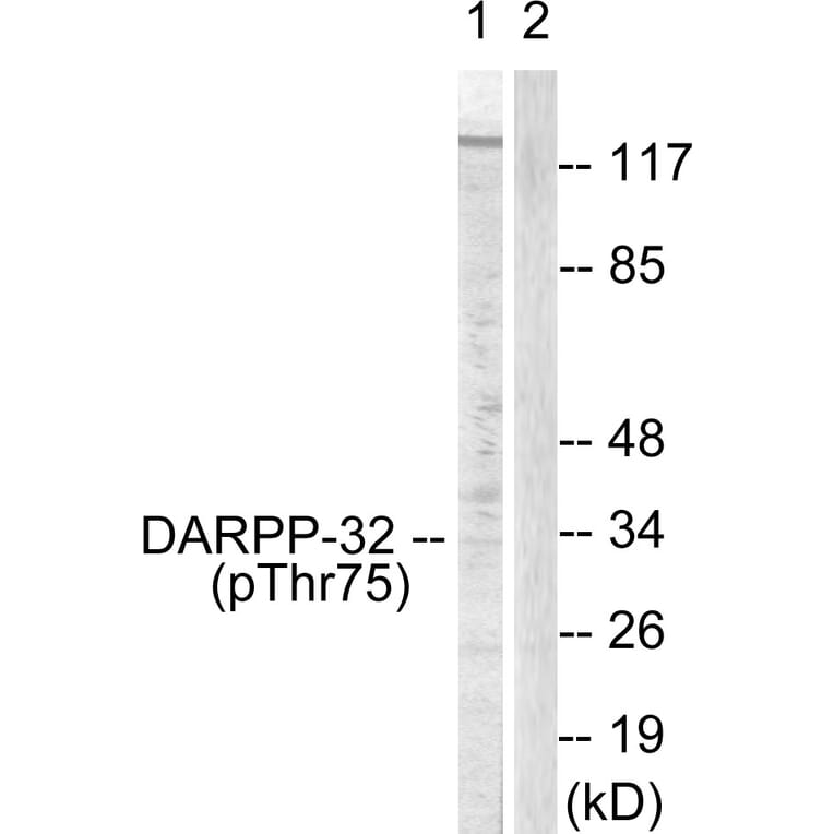 Western Blot - Anti-DARPP-32 (phospho Thr75) Antibody (A0007) - Antibodies.com
