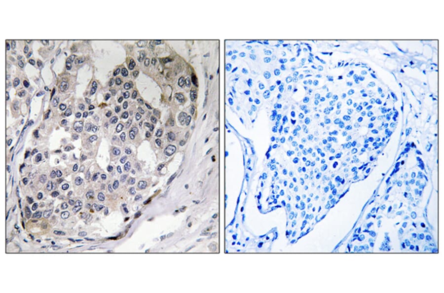 Immunohistochemistry - Anti-DARPP-32 (phospho Thr75) Antibody (A0007) - Antibodies.com
