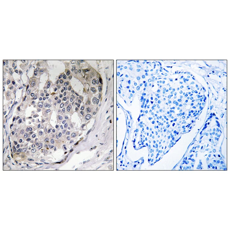 Immunohistochemistry - Anti-DARPP-32 (phospho Thr75) Antibody (A0007) - Antibodies.com