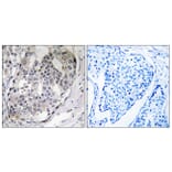 Immunohistochemistry - Anti-DARPP-32 (phospho Thr75) Antibody (A0007) - Antibodies.com