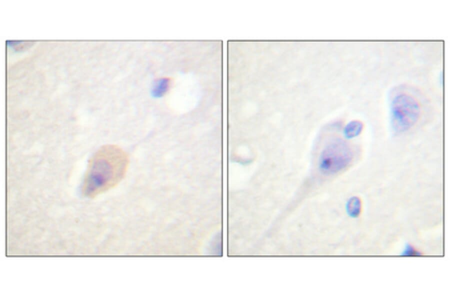 Immunohistochemistry - Anti-DARPP-32 (phospho Thr75) Antibody (A0007) - Antibodies.com