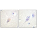 Immunohistochemistry - Anti-DARPP-32 (phospho Thr75) Antibody (A0007) - Antibodies.com