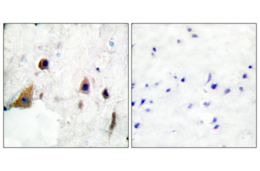 Immunohistochemistry - Anti-DARPP-32 (phospho Thr75) Antibody (A0007) - Antibodies.com