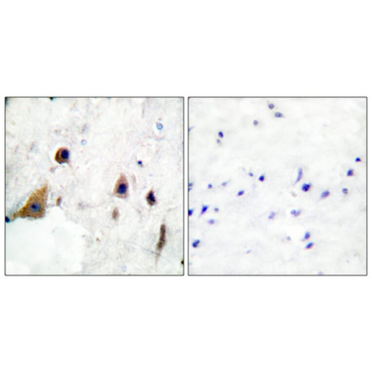 Immunohistochemistry - Anti-DARPP-32 (phospho Thr75) Antibody (A0007) - Antibodies.com