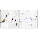 Immunohistochemistry - Anti-DARPP-32 (phospho Thr75) Antibody (A0007) - Antibodies.com