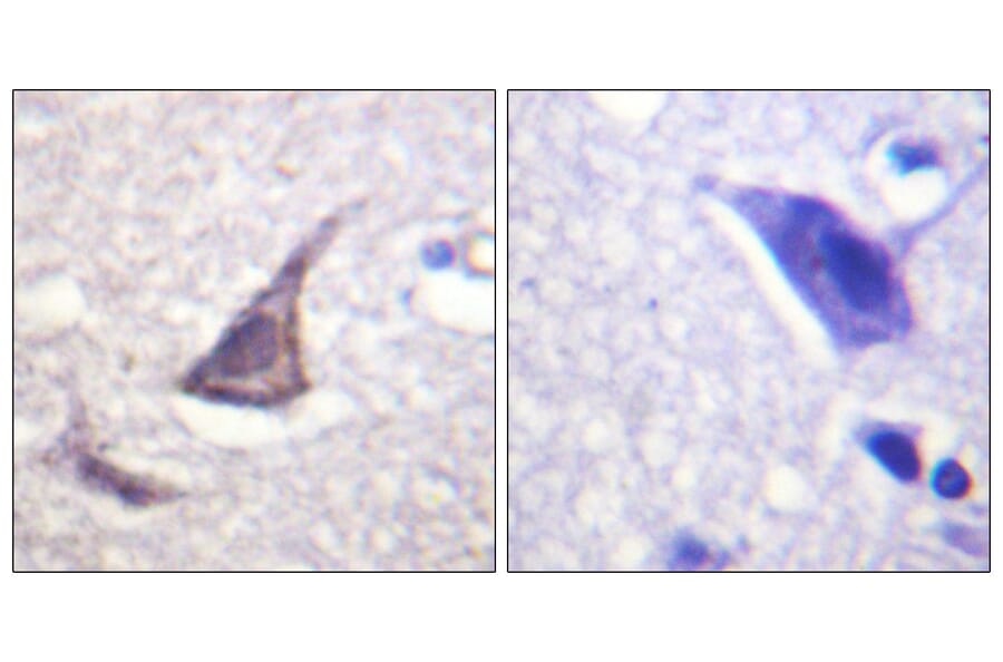 Immunohistochemistry - Anti-Calcium Sensing Receptor Antibody (B0828) - Antibodies.com