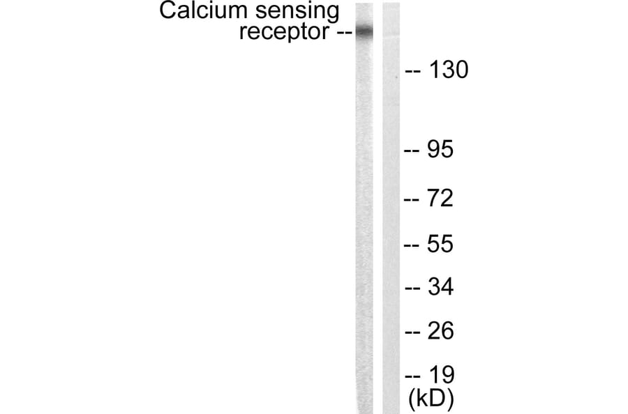 Western Blot - Anti-Calcium Sensing Receptor Antibody (B0828) - Antibodies.com