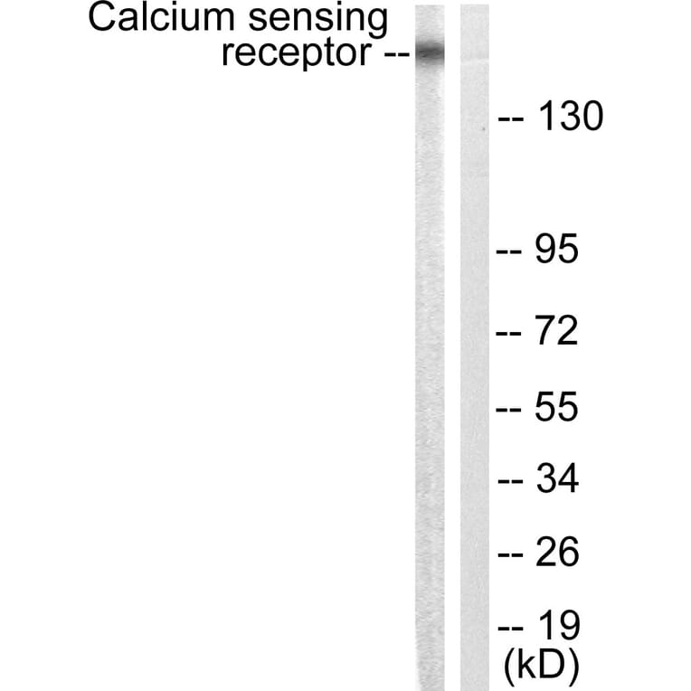 Western Blot - Anti-Calcium Sensing Receptor Antibody (B0828) - Antibodies.com