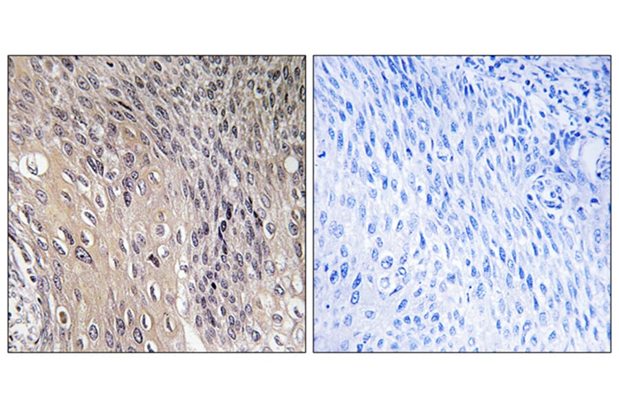 Immunohistochemistry - Anti-ARHGDIA (phospho Ser174) Antibody (A1189) - Antibodies.com