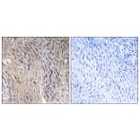 Immunohistochemistry - Anti-ARHGDIA (phospho Ser174) Antibody (A1189) - Antibodies.com