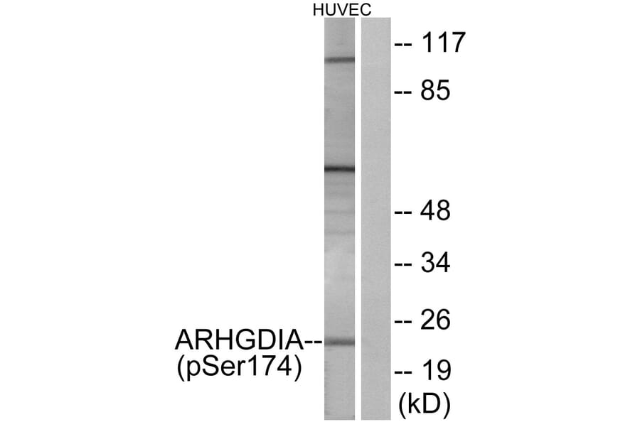 Western Blot - Anti-ARHGDIA (phospho Ser174) Antibody (A1189) - Antibodies.com