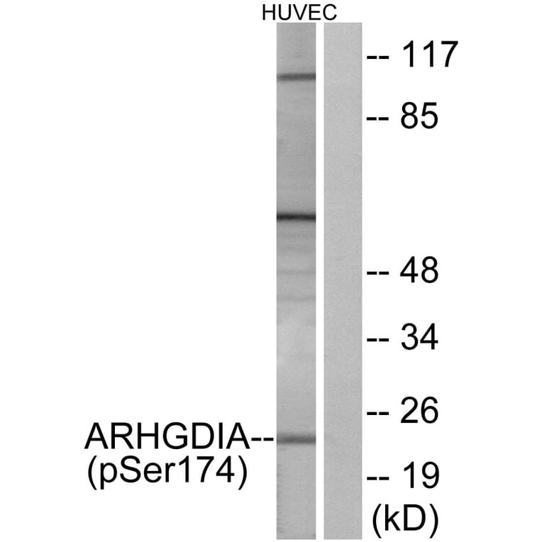 Western Blot - Anti-ARHGDIA (phospho Ser174) Antibody (A1189) - Antibodies.com