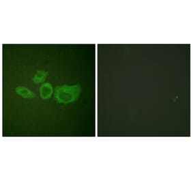 Immunofluorescence - Anti-Tyrosine Hydroxylase Antibody (B0039) - Antibodies.com
