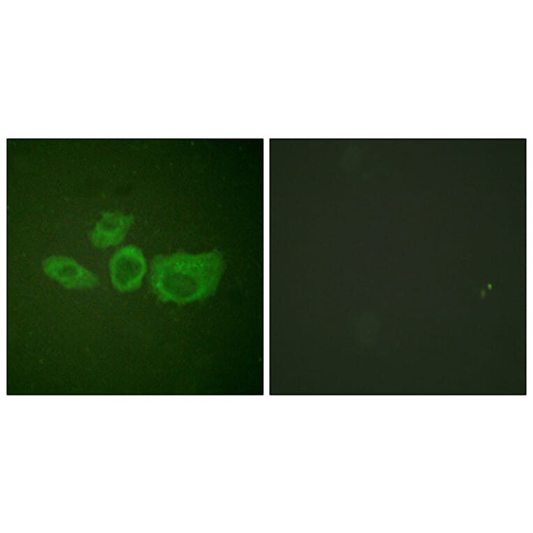 Immunofluorescence - Anti-Tyrosine Hydroxylase Antibody (B0039) - Antibodies.com