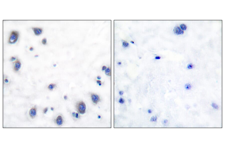 Immunohistochemistry - Anti-Tyrosine Hydroxylase Antibody (B0039) - Antibodies.com