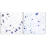 Immunohistochemistry - Anti-Tyrosine Hydroxylase Antibody (B0039) - Antibodies.com