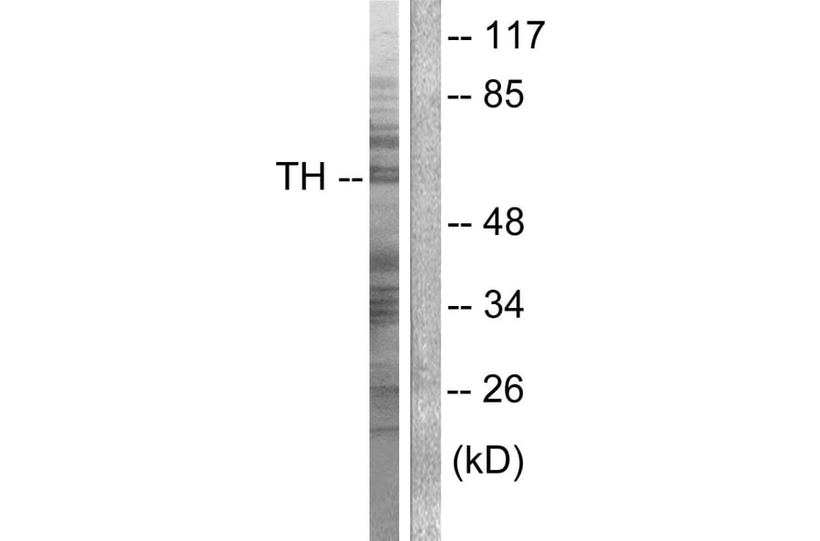 Western Blot - Anti-Tyrosine Hydroxylase Antibody (B0039) - Antibodies.com