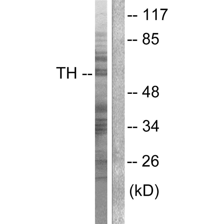 Western Blot - Anti-Tyrosine Hydroxylase Antibody (B0039) - Antibodies.com