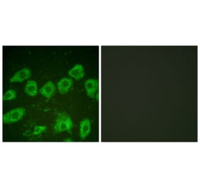 Immunofluorescence - Anti-Tyrosine Hydroxylase Antibody (B0037) - Antibodies.com