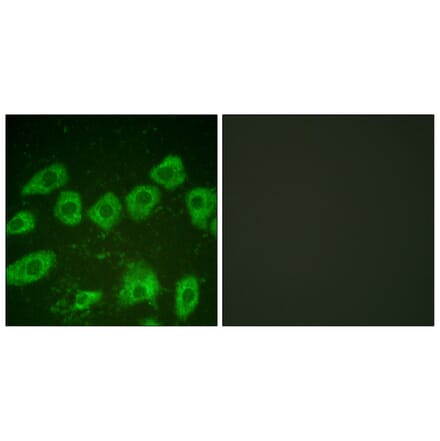 Immunofluorescence - Anti-Tyrosine Hydroxylase Antibody (B0037) - Antibodies.com