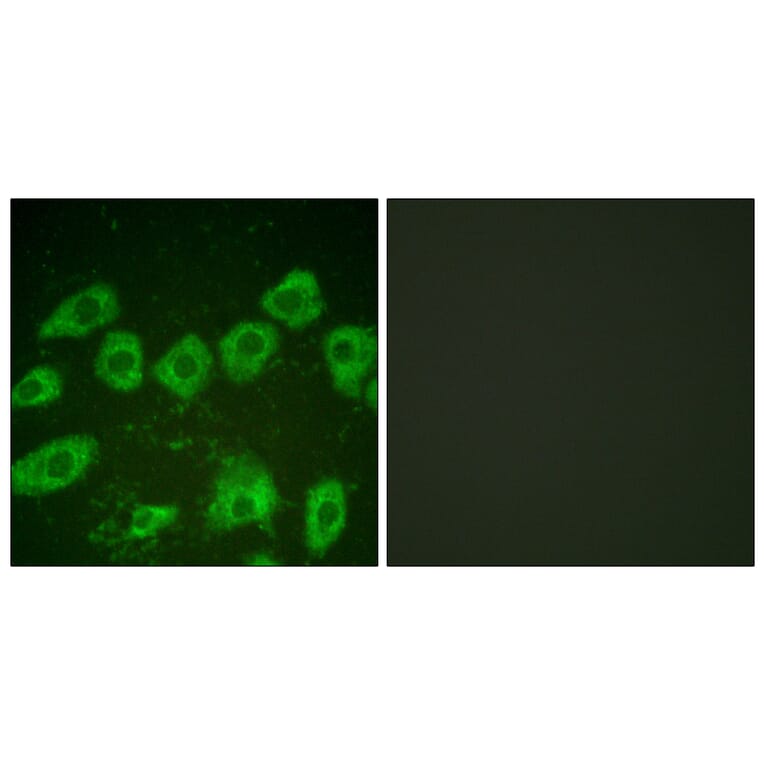 Immunofluorescence - Anti-Tyrosine Hydroxylase Antibody (B0037) - Antibodies.com