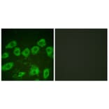 Immunofluorescence - Anti-Tyrosine Hydroxylase Antibody (B0037) - Antibodies.com