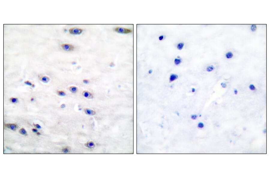 Immunohistochemistry - Anti-Tyrosine Hydroxylase Antibody (B0037) - Antibodies.com