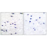 Immunohistochemistry - Anti-Tyrosine Hydroxylase Antibody (B0037) - Antibodies.com