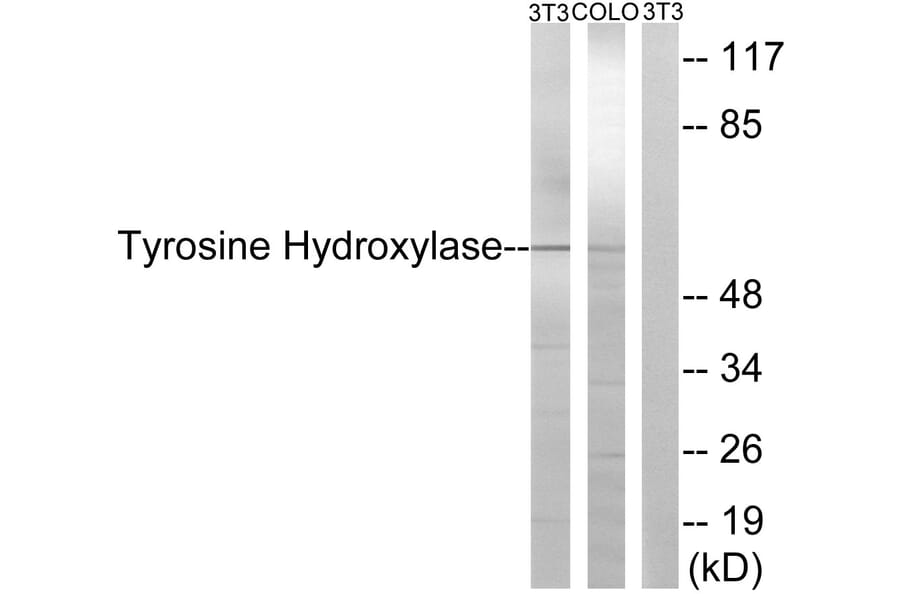 Western Blot - Anti-Tyrosine Hydroxylase Antibody (B0037) - Antibodies.com