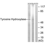 Western Blot - Anti-Tyrosine Hydroxylase Antibody (B0037) - Antibodies.com