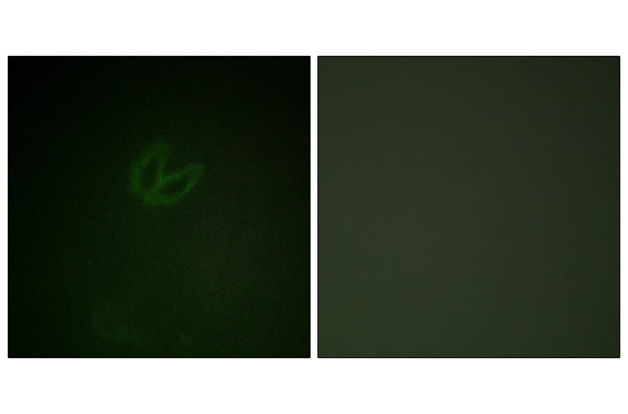 Immunofluorescence - Anti-SYK (phospho Tyr323) Antibody (A0580) - Antibodies.com