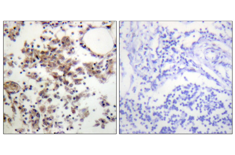 Immunohistochemistry - Anti-SYK (phospho Tyr323) Antibody (A0580) - Antibodies.com