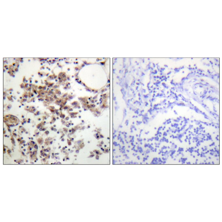 Immunohistochemistry - Anti-SYK (phospho Tyr323) Antibody (A0580) - Antibodies.com