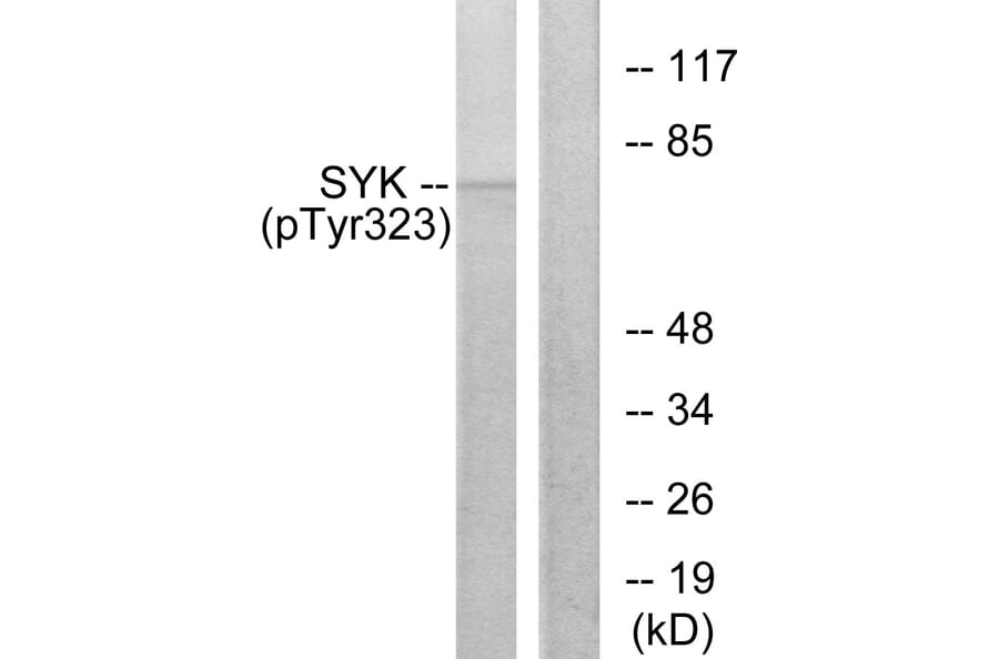 Western Blot - Anti-SYK (phospho Tyr323) Antibody (A0580) - Antibodies.com