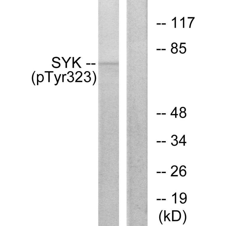 Western Blot - Anti-SYK (phospho Tyr323) Antibody (A0580) - Antibodies.com