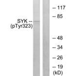 Western Blot - Anti-SYK (phospho Tyr323) Antibody (A0580) - Antibodies.com