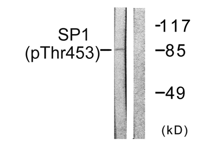 Western Blot - Anti-SP1 (phospho Thr453) Antibody (A0577) - Antibodies.com