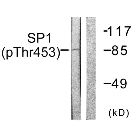 Western Blot - Anti-SP1 (phospho Thr453) Antibody (A0577) - Antibodies.com