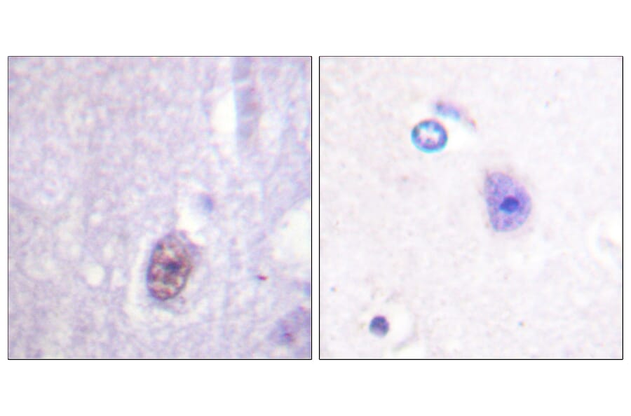 Immunohistochemistry - Anti-SP1 (phospho Thr453) Antibody (A0577) - Antibodies.com
