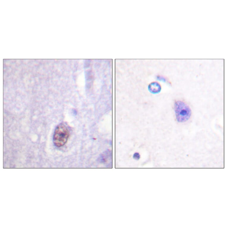 Immunohistochemistry - Anti-SP1 (phospho Thr453) Antibody (A0577) - Antibodies.com