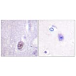 Immunohistochemistry - Anti-SP1 (phospho Thr453) Antibody (A0577) - Antibodies.com