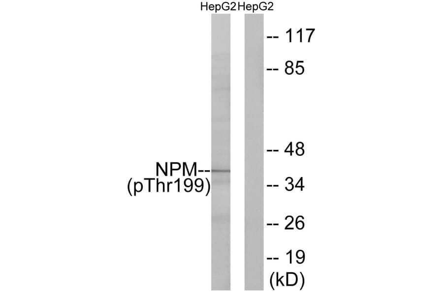 Western Blot - Anti-NPM (phospho Thr199) Antibody (A0694) - Antibodies.com