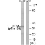 Western Blot - Anti-NPM (phospho Thr199) Antibody (A0694) - Antibodies.com